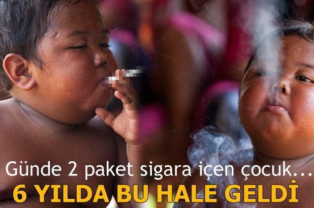 İki Yaşındayken Günde 2 Paket Sigara İçen Çocuk 6 Yılda Bakın Ne Hale Geldi!