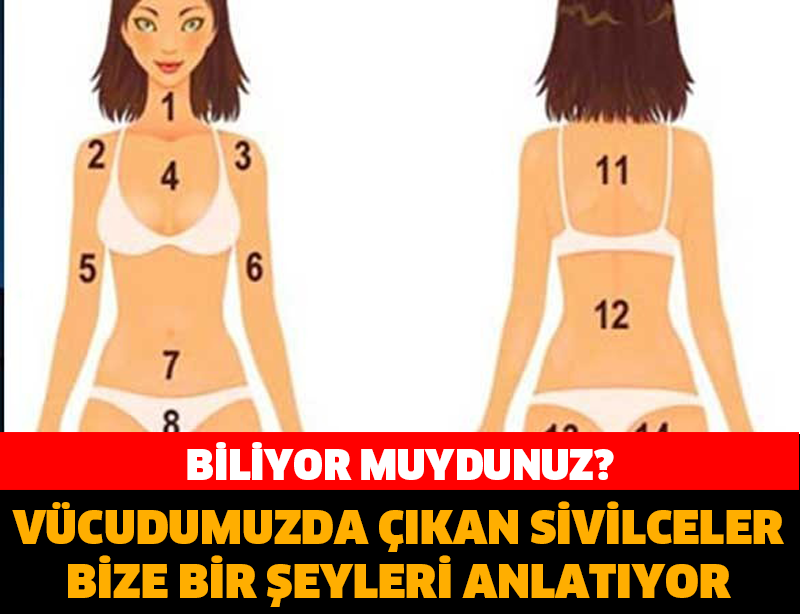 BİLİYORMUYDUNUZ? VÜCUDUMUZDA ÇIKAN SİVİLCELER BİZE NEYİ ANLATIYOR?