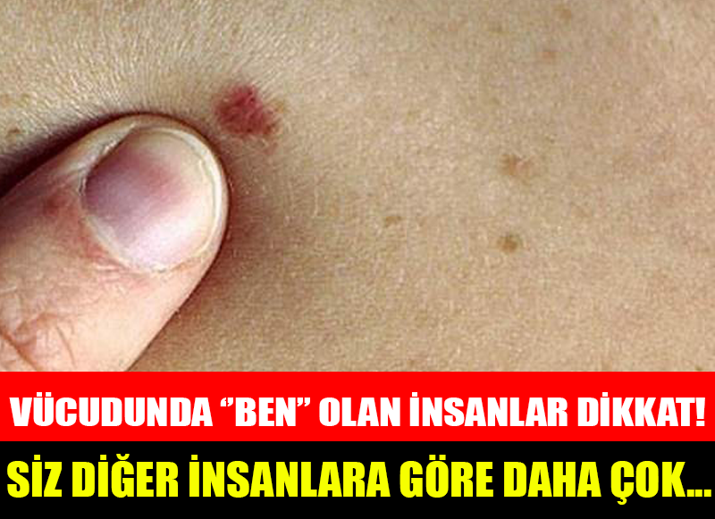 VÜCUDUNDA ''BEN'' OLAN İNSANLAR DİKKAT! BU HABER SİZİ İLGİLENDİRİYOR...