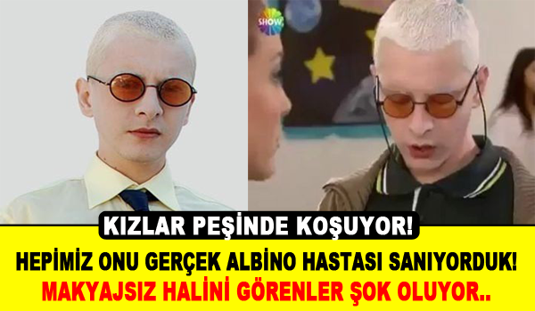 Hepimiz Onu Albino Hastası Sanıyorduk Ama.. Makyajsız Hali Şok Ediyor!