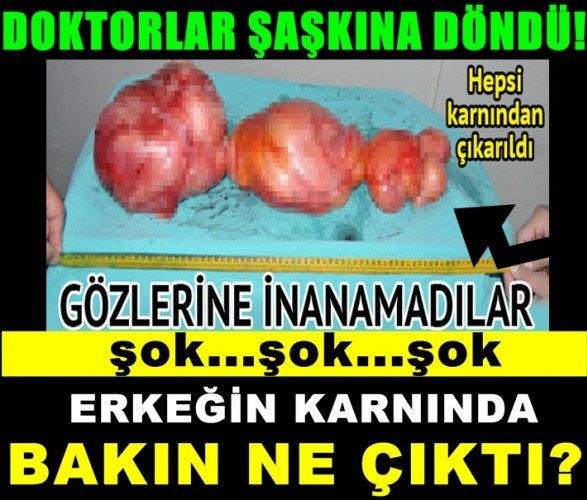 ERKEĞİN KARNINDA BAKIN NE ÇIKTI!