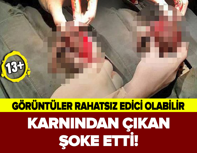 KARNINDAN ÇIKAN ŞOKE ETTİ!