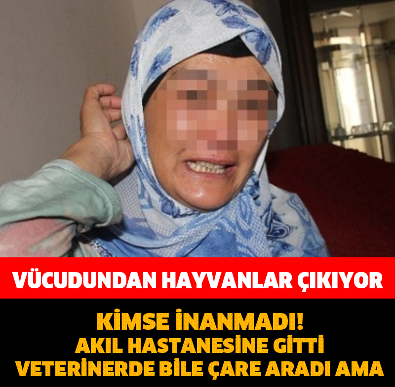 BU KADININ VÜCUDUNDAN HAYVANLAR ÇIKIYOR! KİMSE ONA İNANMADI AMA...