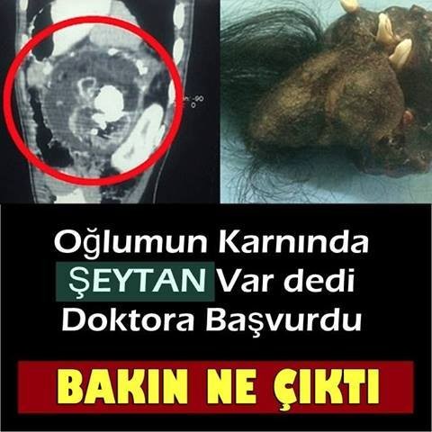 OĞLUMUN KARNINDAN ŞEYTAN VAR DEDİ DOKTORA BAŞVURDU!!