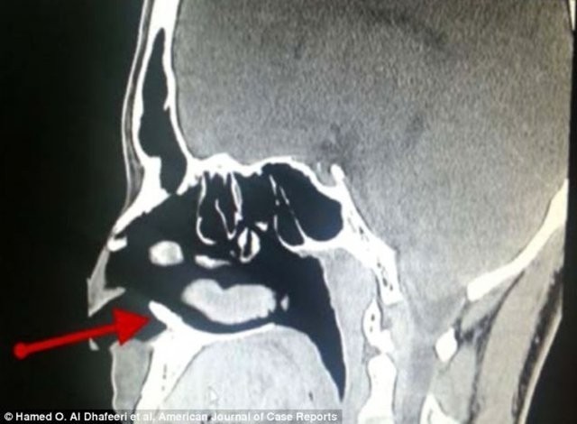 Burnu Kanadığı İçin Doktora Gitti Fakat Sebebini Öğrenince Şoke Oldu!