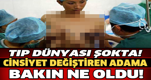 CİNSİYET DEĞİŞTİREN ADAMA BAKIN NE OLDU ?