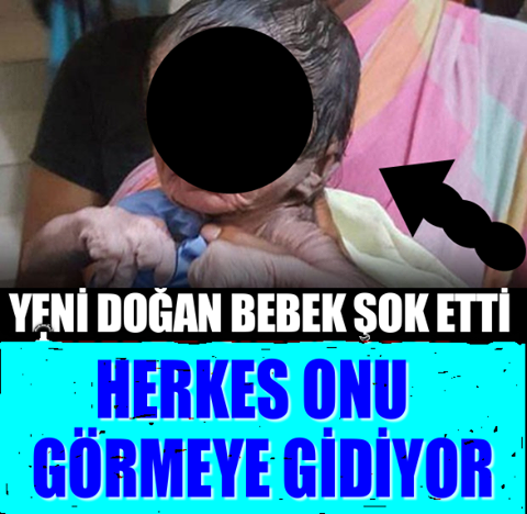 Bu bebek bugün Dünya’ya geldi! Gören gözlerine inanamıyor...