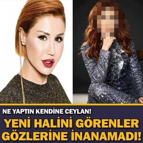 NE YAPTIN KENDİNE CEYLAN! YENİ HALİNİ GÖRENLER GÖZLERİNE İNANAMADI!