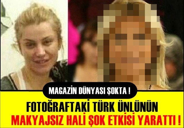 HİÇ HATIRLADIĞINIZ GİBİ DEĞİL! BAKIN NE HALDE...TÜRK MAGAZİN DÜNYASI ŞOKTA !