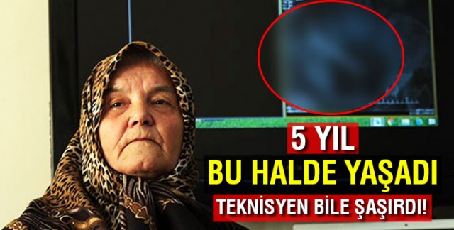 Röntgeni çeken teknisyen bile şaşırdı! 5 Yıl boyunca...