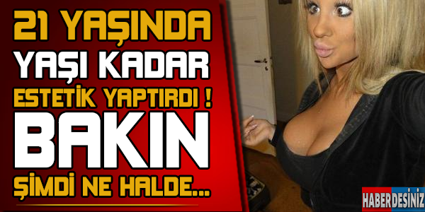 21 Yaşında yaşı kadar estetik yaptırdı ! Bakın şimdi ne halde...