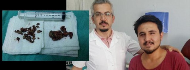 BAŞ AĞRISI İLE DOKTORA GİTTİ, BURNUNDAN ÇIKANLARI GÖREN DOKTOR FENALAŞTI....