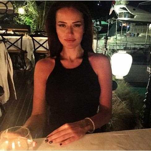 Fahriye Evcen'in yüzüne ne oldu ? Görünce çok şaşıracaksınız...