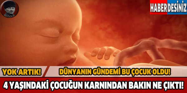 Bu bebek dünyayı şaşkına çevirdi!