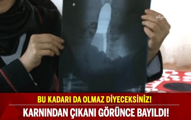 BU KADARI DA OLMAZ DİYECEKSİNİZ!KARNINDAN ÇIKANI GÖRÜNCE BAYILDI!