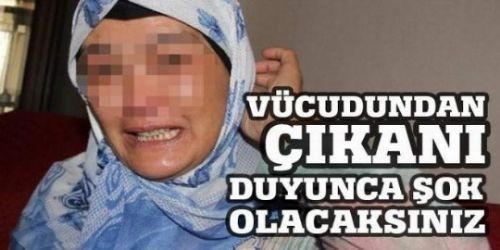 BU KADININ VÜCUDUNDAN HAYVANLAR ÇIKIYOR! KİMSE ONA İNANMADI AMA...