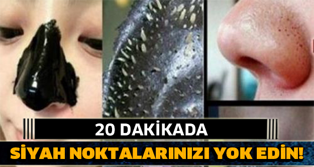 20 DAKİKADA SİYAH NOKTALARINIZI YOK EDİN!