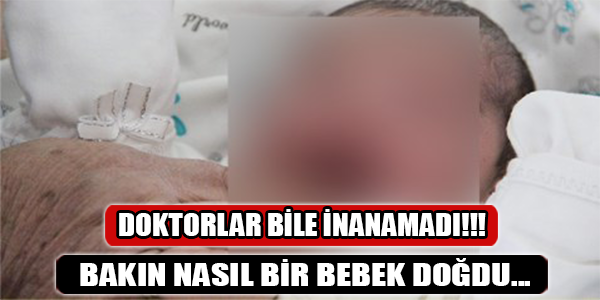 DOKTORLAR BİLE İNANAMADI! BU BEBEK...