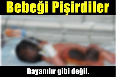 Yok Böyle Vicdansızlık !! Bebeği Pişirdiler Ve...