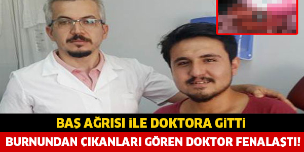 BAŞ AĞRISI İLE DOKTORA GİTTİ, BURNUNDAN ÇIKANLARI GÖREN DOKTOR FENALAŞTI....