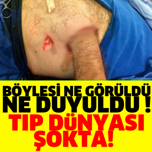 BÖYLESİ NE GÖRÜLDÜ NE DUYULDU ! TIP DÜNYASI ŞOKTA!