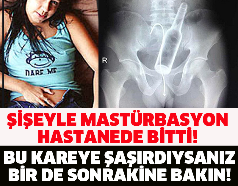 ŞİŞEYLE MASTÜRBASYON  HASTANEDE BİTTİ! BU KAREYE ŞAŞIRDIYSANIZ  BİR DE SONRAKİNE BAKIN!