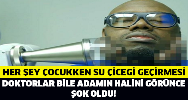 DOKTORLAR BİLE ADAMIN HALİNİ GÖRÜNCE ŞOKE OLDU...