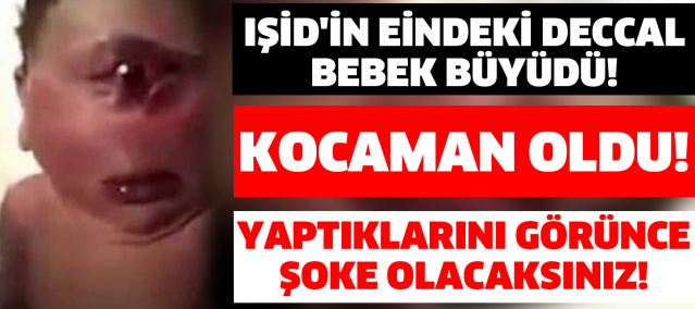 Şimdi Herkes Onu Konuşuyor! Dünyanın Konuştuğu Deccal Bebek Büyüdü!