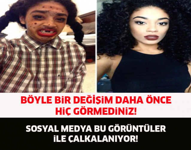 BÖYLE BİR DEĞİŞİM DAHA ÖNCE HİÇ GÖRMEDİNİZ..!