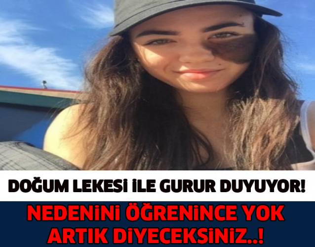 DOĞUM LEKESİ İLE GURUR DUYUYOR! NEDENİNİ ÖĞRENİNCE ŞOK OLACAKSINIZ..!