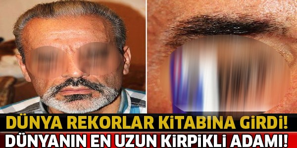 Dünya Rekorlar Kitabına Girdi ! Dünyanın En Uzun Kirpiklerine Sahip ..