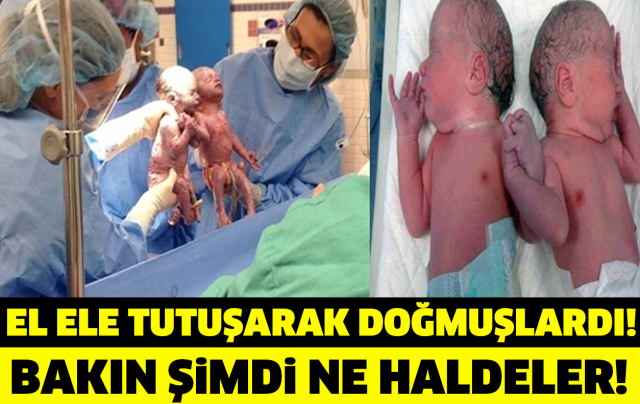 El Ele Tutuşarak Doğmuşlardı! Bakın Şimdi Ne Haldeler!