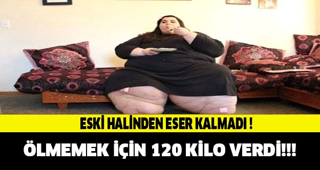 Yaşamak için 120 kilo verdi !