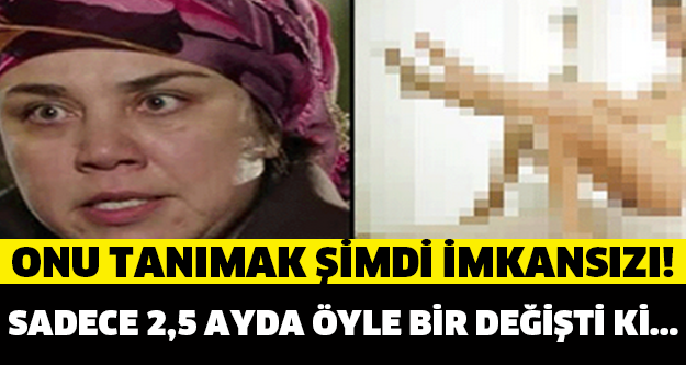 ÜNLÜ OYUNCU 2.5 AYDA ÖYLE BİR DEĞİŞTİ Kİ ! ŞİMDİKİ HALİNİ TANIMAK İMKANSIZ...