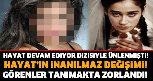 Hayat Devam Ediyor Dizisiyle Ünlenmişti! Bakın Şimdi Ne Halde?