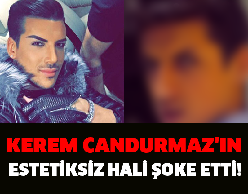 KEREM CANDURMAZ'IN ESTETİKSİZ HALİ ŞOKE ETTİ!