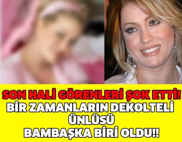 SON HALİ GÖRENLERİ ŞOK ETTİ! BİR ZAMANLARIN DEKOLTELİ ÜNLÜSÜ BAMBAŞKA BİRİ OLDU!!