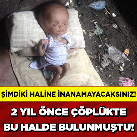 2 Yıl Önce Bu Haldeydi, Şimdi İse…