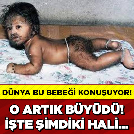 İŞTE O BEBEĞİN ŞİMDİKİ HALİ...