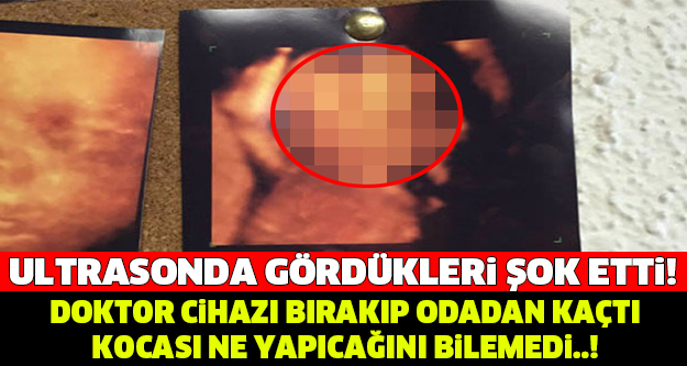 ULTRASONDA GÖRDÜKLERİ DEHŞETE DÜŞÜRDÜ... DOKTOR CİHAZI BIRAKIP ODADAN KAÇTI, KOCA NE YAPACAĞINI BİLEMEDİ...