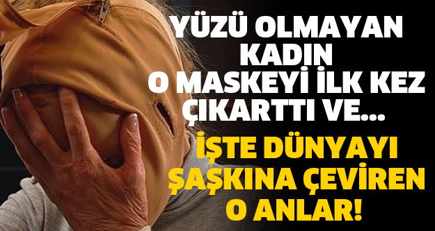 İŞTE DÜNYAYI ŞAŞKINA ÇEVİREN O ANLAR! YÜZÜ OLMAYAN KADIN O MASKEYİ İLK KEZ ÇIKARTTI VE...