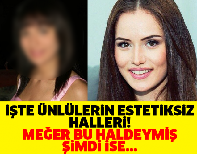 İŞTE ÜNLÜLERİN ESTETİKSİZ HALLERİ! MEĞER BU HALDEYMİŞ ŞİMDİ İSE...