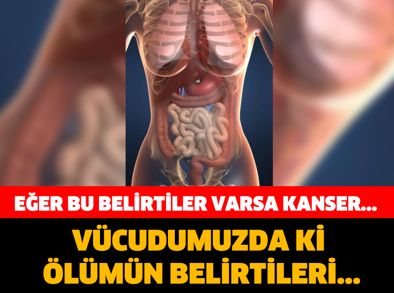 Vücudumuzdaki Ölüm Belirtileri !