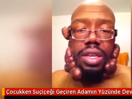 DOKTORLAR BİLE ADAMIN HALİNİ GÖRÜNCE ŞOKE OLDU...