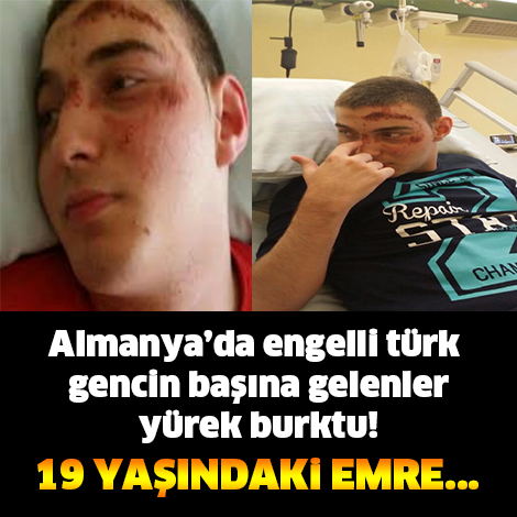 ALMANYA'DA ENGELLİ TÜRK GENCİN BAŞINA GELENLER YÜREK BURKTU! 19 YAŞINDAKİ EMRE...