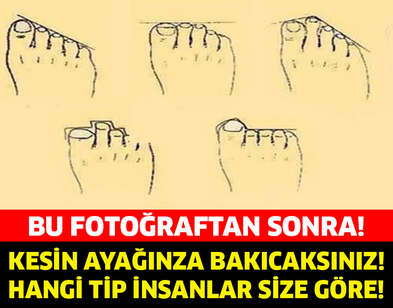 BU FOTOĞRAFTAN SONRA KESİN AYAĞINIZA BAKACAKSINIZ....