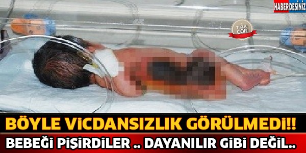 Yok Böyle Vicdansızlık !! Bebeği Pişirdiler Ve...