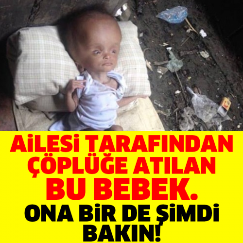 AİLESİ TARAFINDAN ÇÖPLÜĞE ATILAN BU BEBEK... ONA BİR DE ŞİMDİ BAKIN!