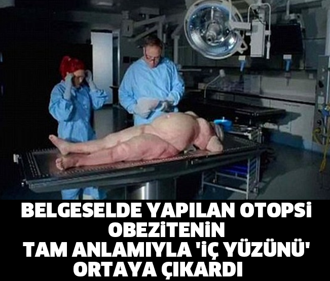 BELGESELDE YAPILAN OTOPSİ OBEZİTENİN TAM ANLAMIYLA 'İÇ YÜZÜNÜ' ORTAYA ÇIKARDI...