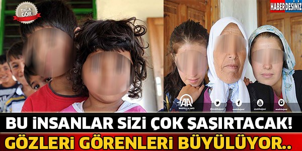 Bu İnsanların Gözleri Herkesi Büyülüyor ! Görünce Şoke Olacaksınız...